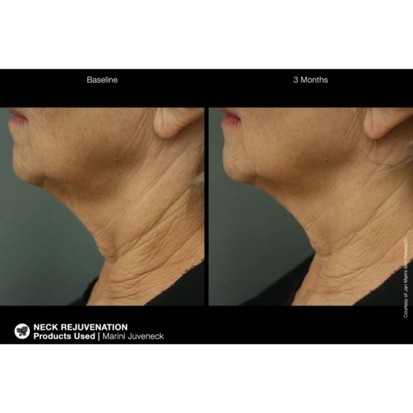 Jan Marini Juveneck Neck Cream