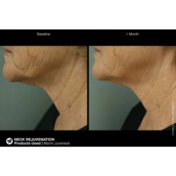 Jan Marini Juveneck Neck Cream