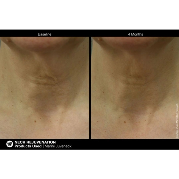 Jan Marini Juveneck Neck Cream