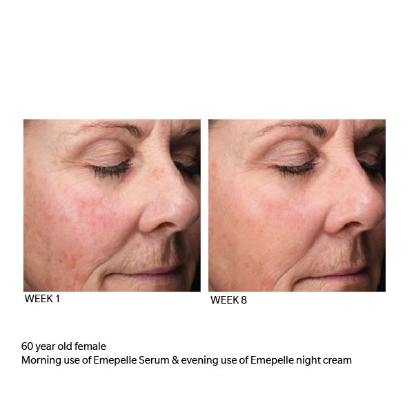 emepelle products results