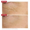 dr levy eye booster concentrate before and after