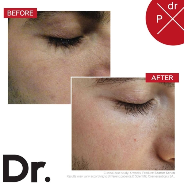 dr levy before and after booster serum