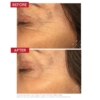 dr levy r3 cell matrix mask before and after