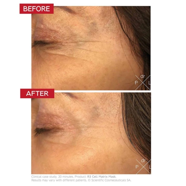 dr levy r3 cell matrix mask before and after