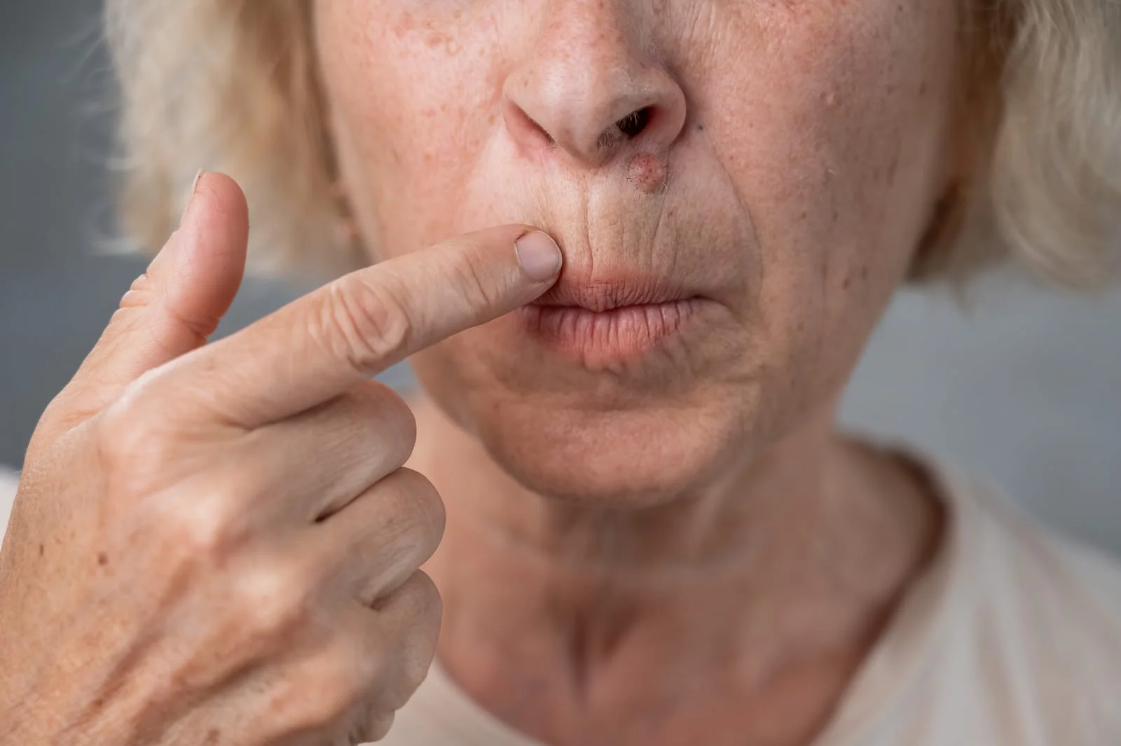 Menopause and Dry Skin