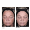 Before and after of a woman showing improved skin glow and firmness after using Lumity Morning and Night Female Refill