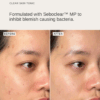 Before and after comparison showing improved skin clarity and reduced blemishes after using Alpha H Clear Skin Tonic