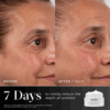 Before and after results with Medik8 Advanced Pro Collagen Peptide Cream showing visibly firmer, smoother, and more youthful-looking skin.