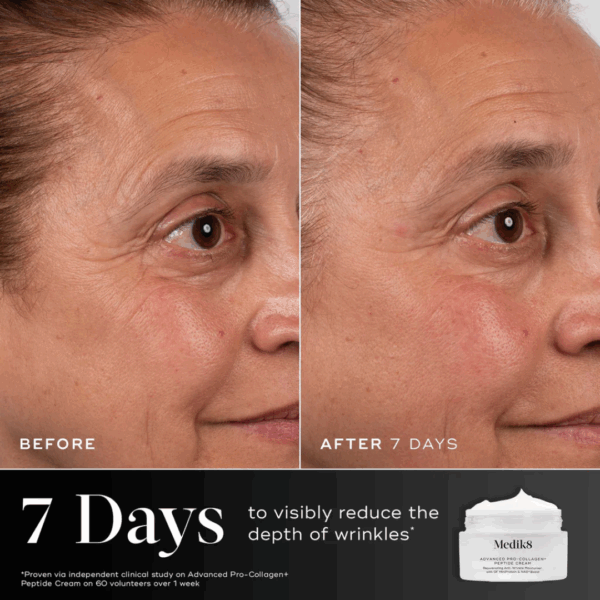 Before and after results with Medik8 Advanced Pro Collagen Peptide Cream showing visibly firmer, smoother, and more youthful-looking skin.