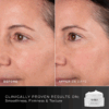 Before and after results with Medik8 Advanced Pro Collagen Peptide Cream 50ml.