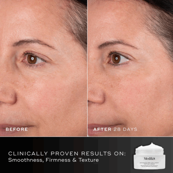 Before and after results with Medik8 Advanced Pro Collagen Peptide Cream 50ml.