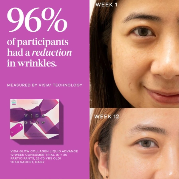 Vida Glow Super Skin Set