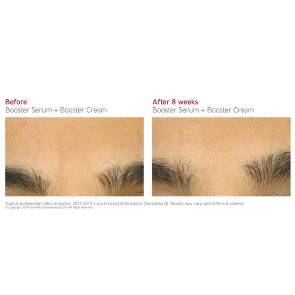 booster serum and cream before after 2 dermoi!