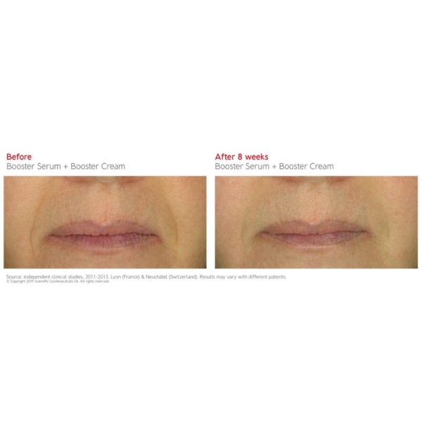 booster serum and cream before after 3 dermoi!