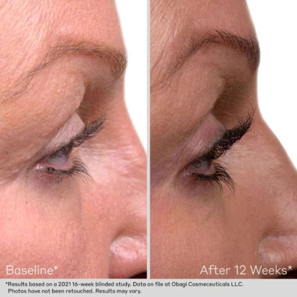 obagi lash serum before and after