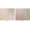 osmosis crepe correct cream before and after