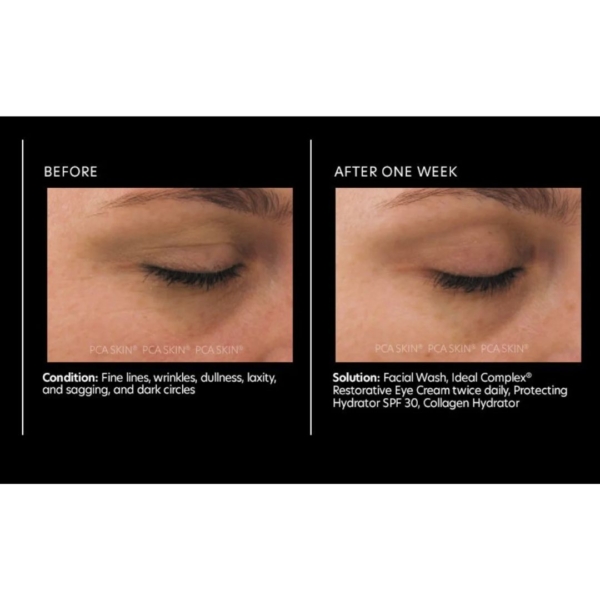 Before and after results of PCA Skin Ideal Complex Restorative Eye Cream.