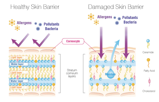 understanding skin barrier to find a good skin moisturiser​