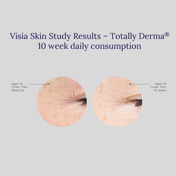 totally derma collagen before and after image from clinical trial