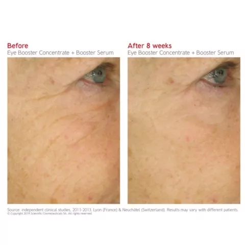 Dr Levy Eye Booster Concentrate before and after