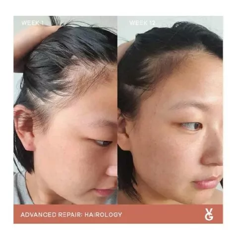 Vida Glow Hairology Advanced Repair before and after