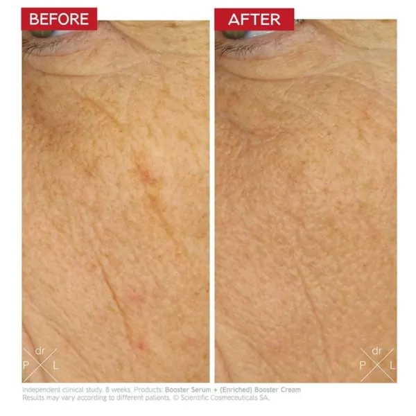 Dr levy Booster Cream reviews