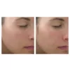 Jan Marini C-esta face serum before after