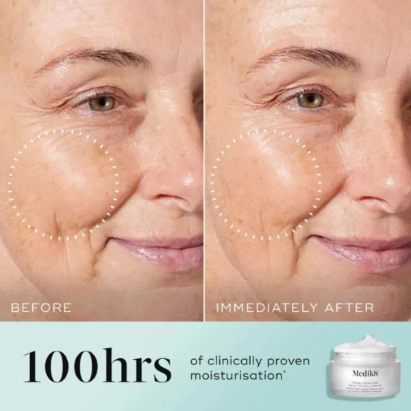Medik8 Total Moisture Daily Facial Cream before and after