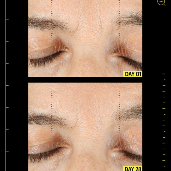 Image showing visible improvements of fine lines and density at the forehead after using allies of skin retinal and peptides repair night cream for 28 days