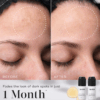 Before and after using Medik8 OXY-R Peptides showing reduced dark spots and brighter, more even skin tone on a woman’s face