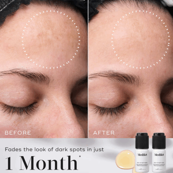 Before and after using Medik8 OXY-R Peptides showing reduced dark spots and brighter, more even skin tone on a woman’s face