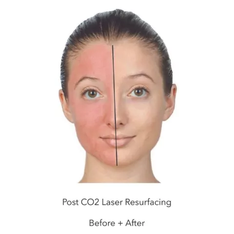 Oxygenetix Foundation - Before and after procedure