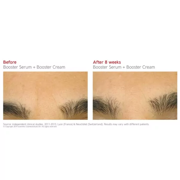 Dr Levy Booster Cream before and after