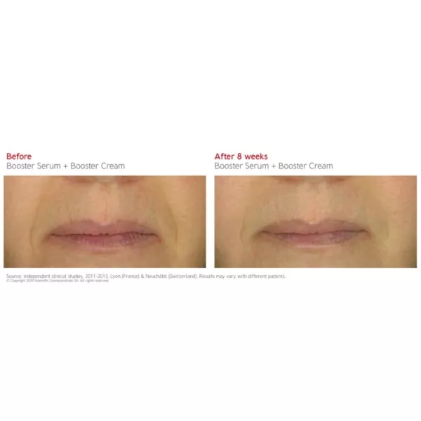 Dr Levy Booster Cream before and after