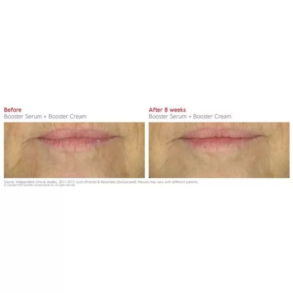 Dr Levy Booster Cream before and after