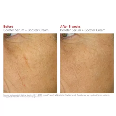 Dr Levy Booster Cream before and after