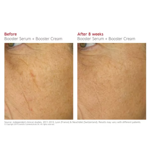 Dr Levy Booster Cream before and after