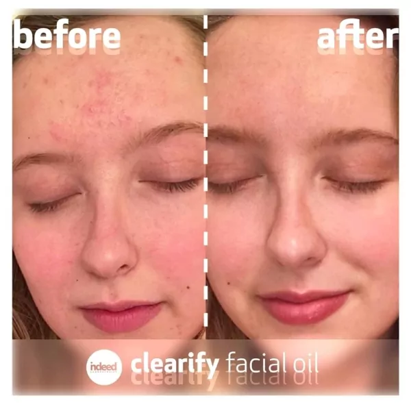 Indeed Labs Clearify Facial Oil