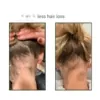 natucain hair activator growth serum before and after results