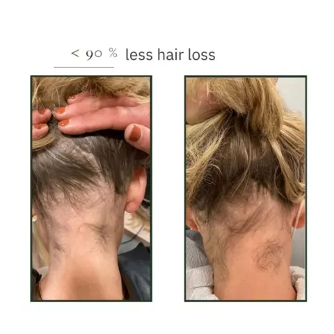 natucain hair activator growth serum before and after results