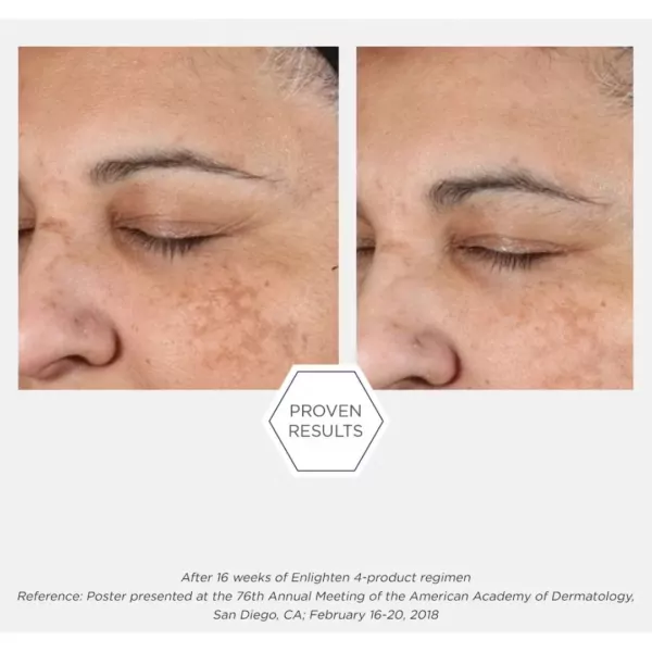 neostrata before and after