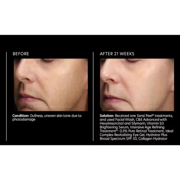 PCA Skin Vitamin B3 Brightening Serum