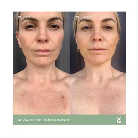 vida glow before and after
