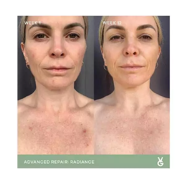 vida glow before and after