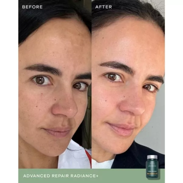vida glow radiance+ before and after